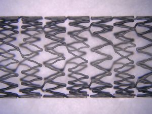 Nitinol stent surface (20x) after edge-rounding with glass bead and processing with aluminum oxide.