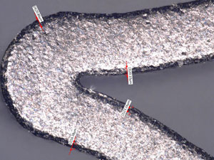 Stent surface after OD blast with 35 µ glass bead (500x); before surface finish with AlOx
