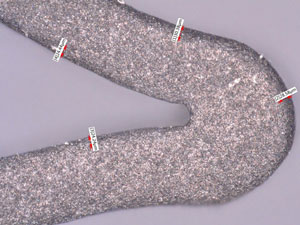Stent surface  (500x) after 100 µ glass bead and 17.5 µ aluminum oxide.